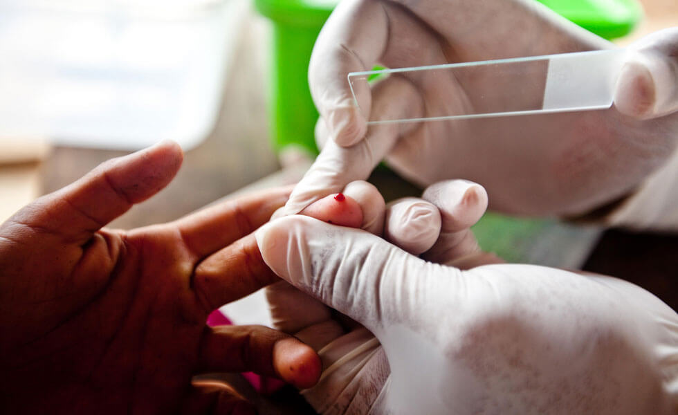 La vacuna requiere la administración de cuatro dosis: 7 meses, 8 meses, 9 meses y la cuarta un año y medio después.