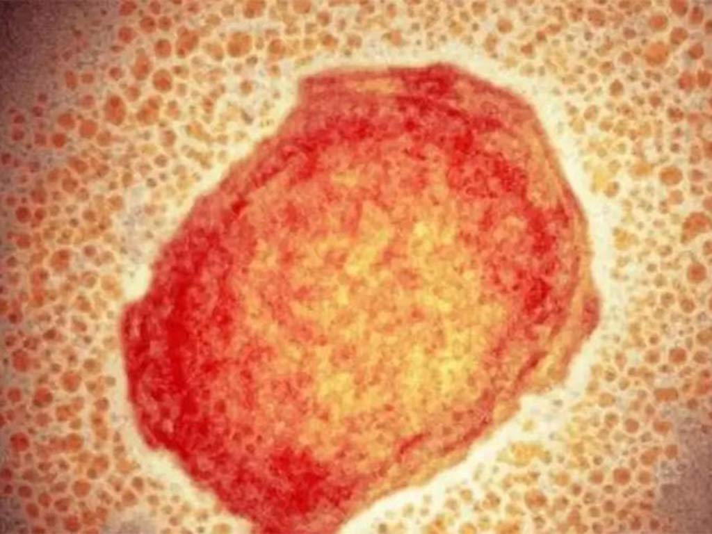 Virus Viruela Mono Mpox / Foto: Prensa Latina