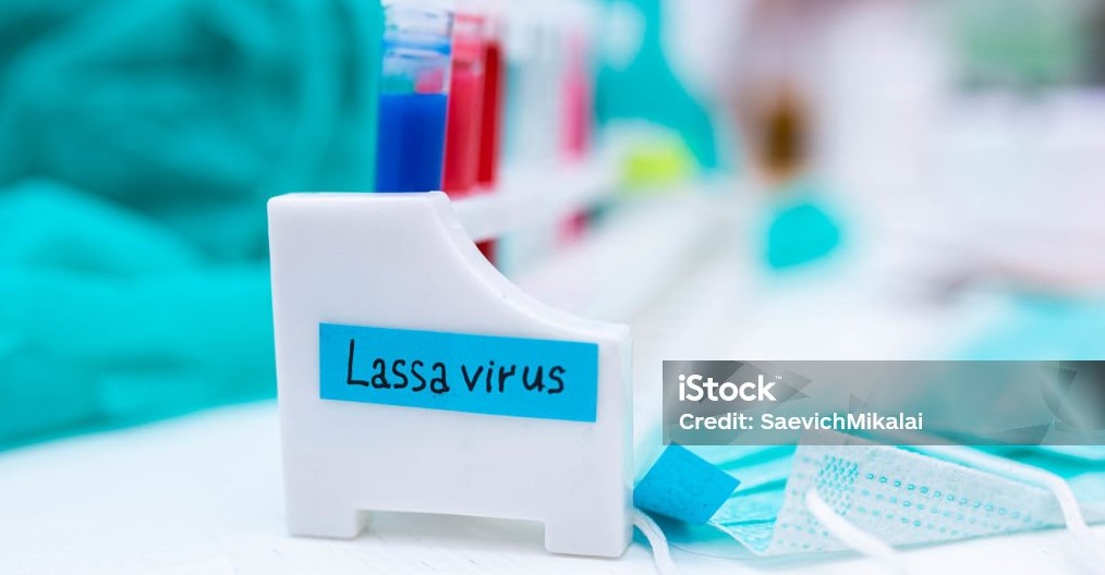 Lassa virus