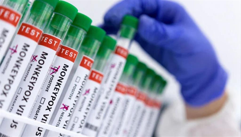 Mpox Viruela del mono Virus 